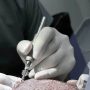 Manual Punch FUE Technique – The Safest Method for Hair Extraction