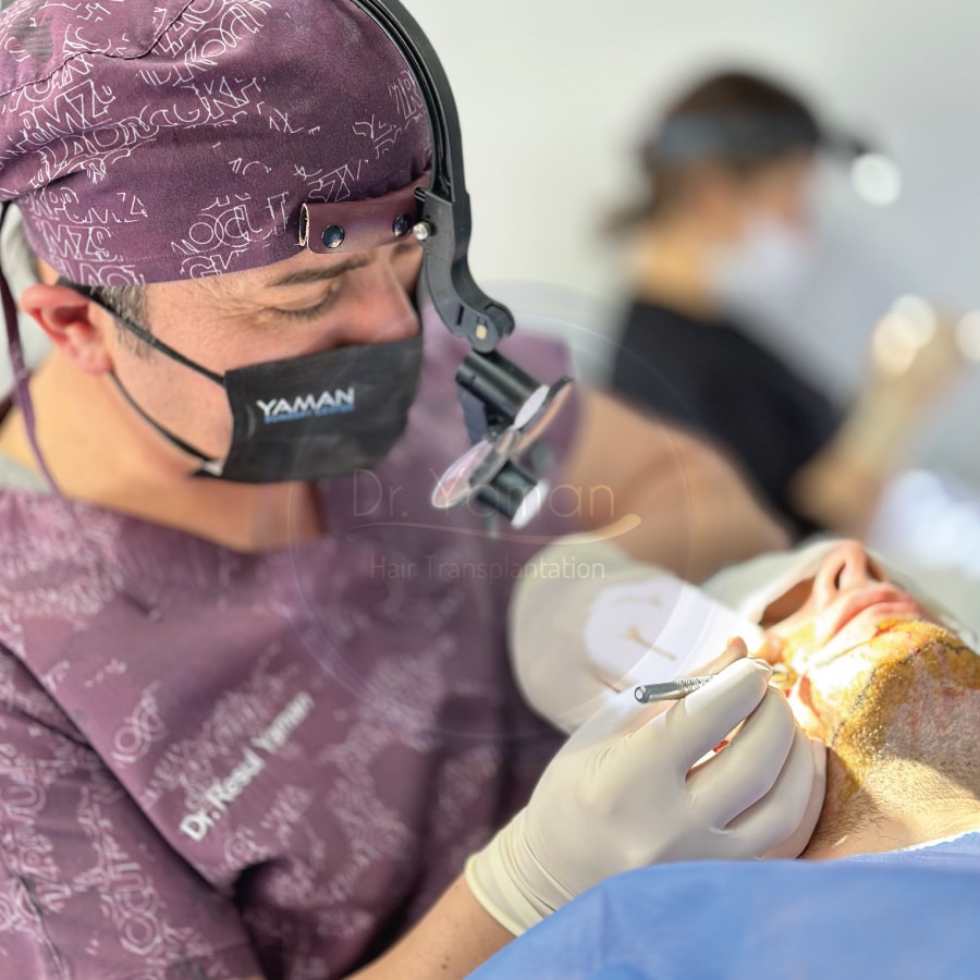 Beard Hair Transplant Cost in Turkey