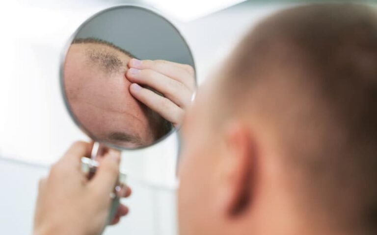 Man using a mirror to inspect scalp micropigmentation