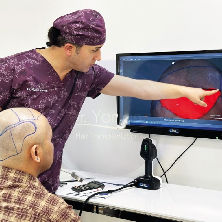 DHI hair transplant