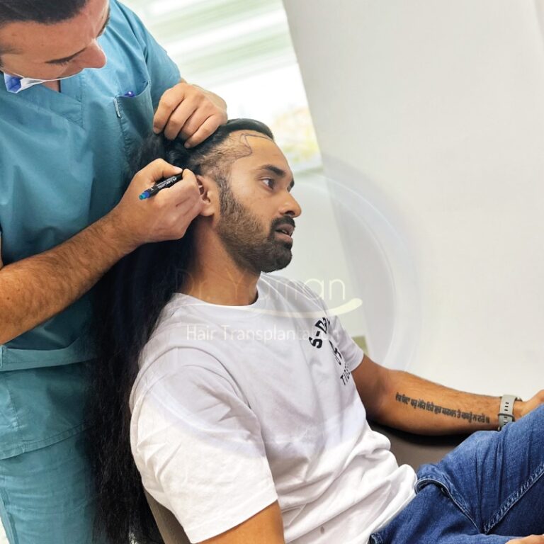Hair Transplant Surgery