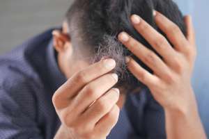 stress and hair loss