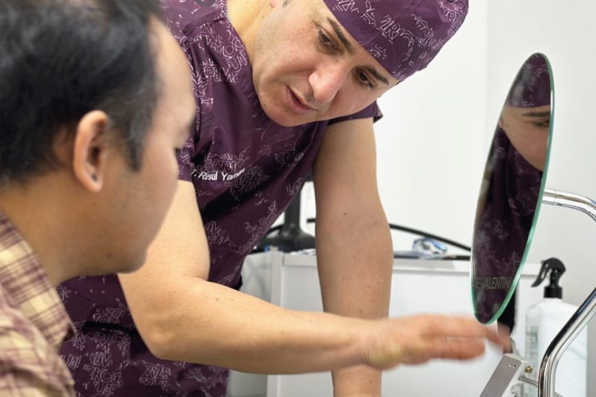 Trasplante de cabello de otra persona: ¿Es posible?