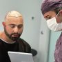 Capelli trapiantati cadono dopo 1 o 2 anni: Cosa fare?