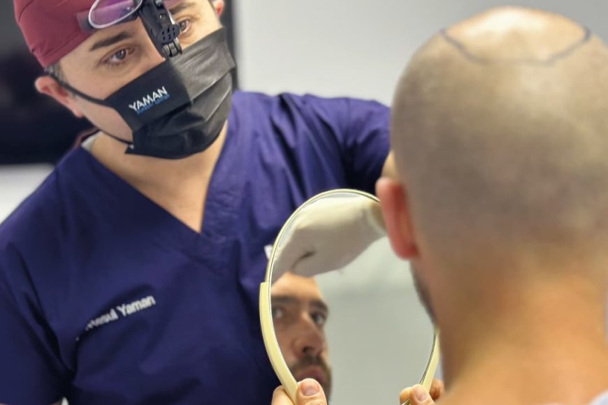 ¿Cuál es la Tasa de Éxito de los Trasplantes de Cabello en Turquía?