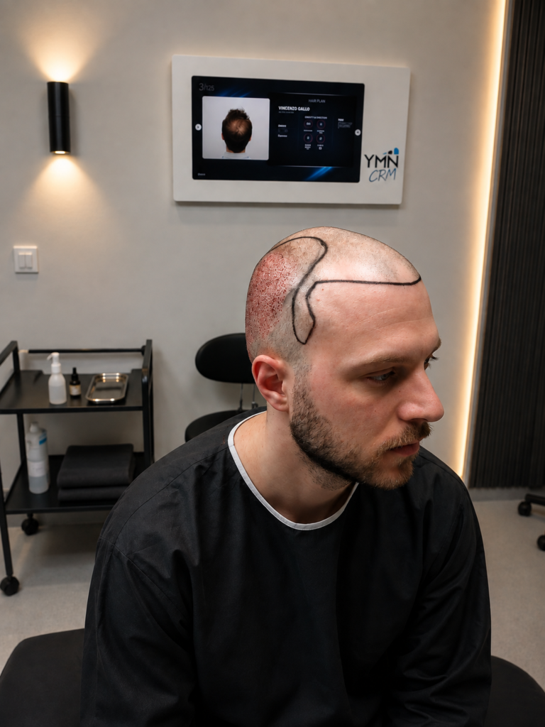 Big Forehead