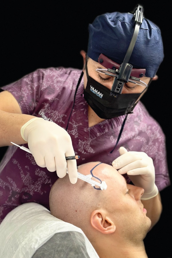 Big Forehead Vs Receding Hairline What Is The Difference Dr Resul 