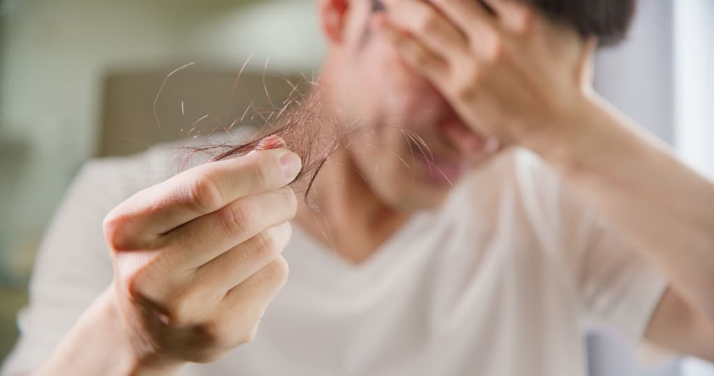 man worried about his receding hairline