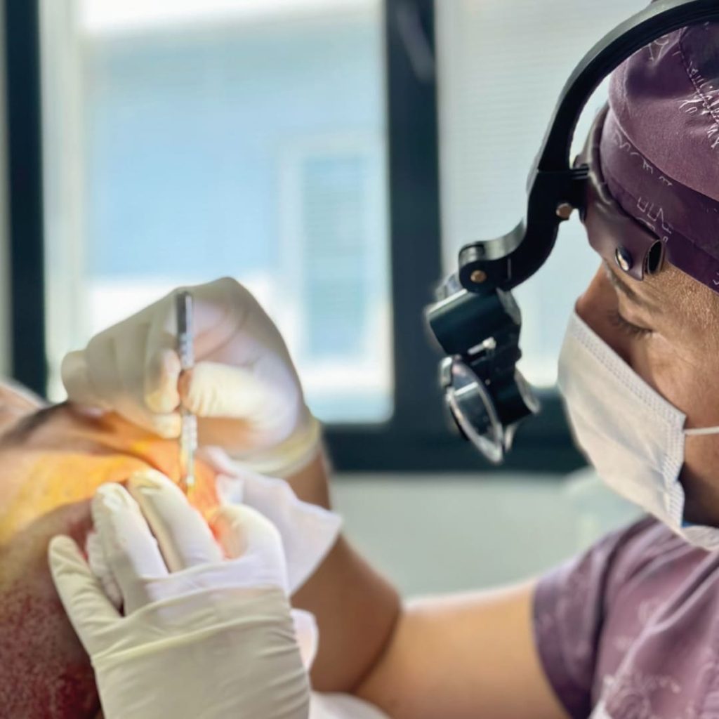 Turkey hair transplant package