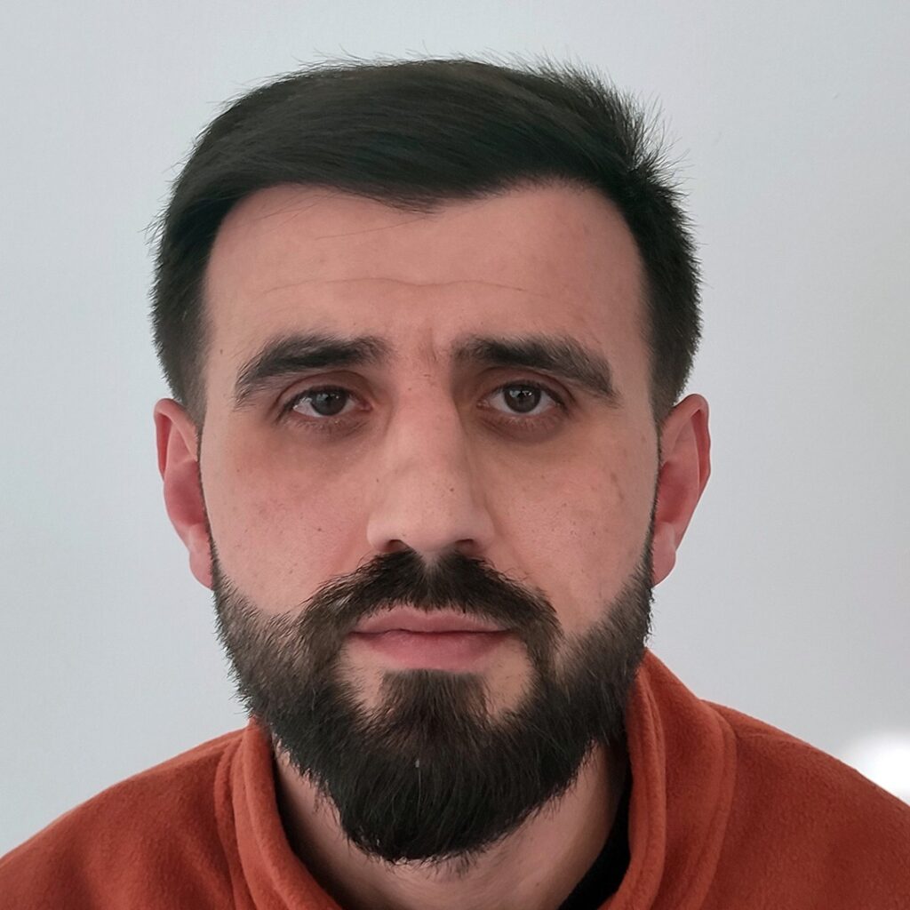 4280 grafts hair transplant before and after - patient photo 11