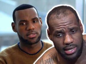 Trapianto di capelli di LeBron James prima e dopo