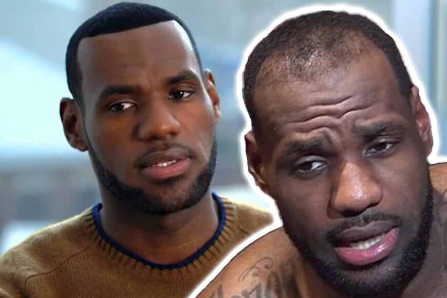 Transplante Capilar LeBron James Antes e Depois