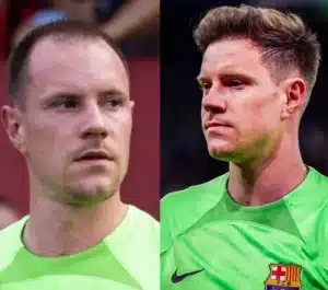 Trapianto di capelli Ter Stegen