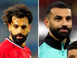 Mo Salah Hair Transplant: Did He Have Hair Surgery?