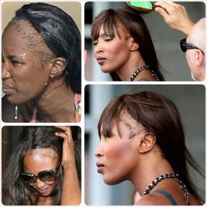 Naomi Campbell Hair Loss: What Solution Did the Supermodel Choose?