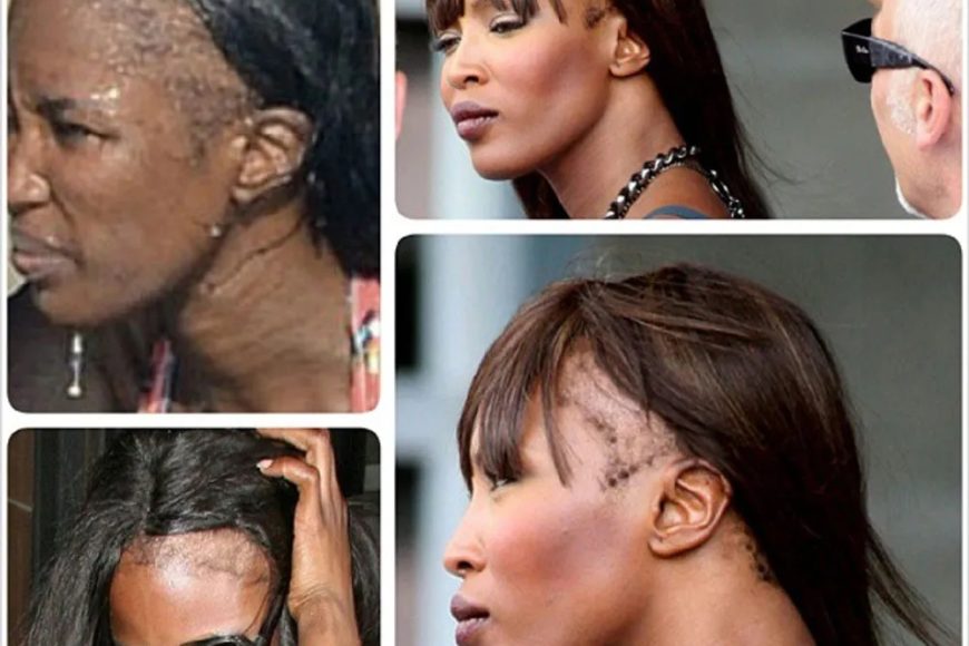 Naomi Campbell Hair Loss: What Solution Did the Supermodel Choose?
