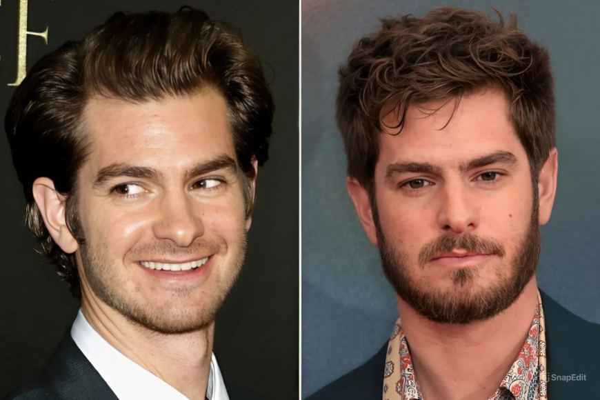 Andrew Garfield Hair Transplant
