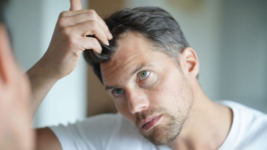 Anemia and Hair Loss