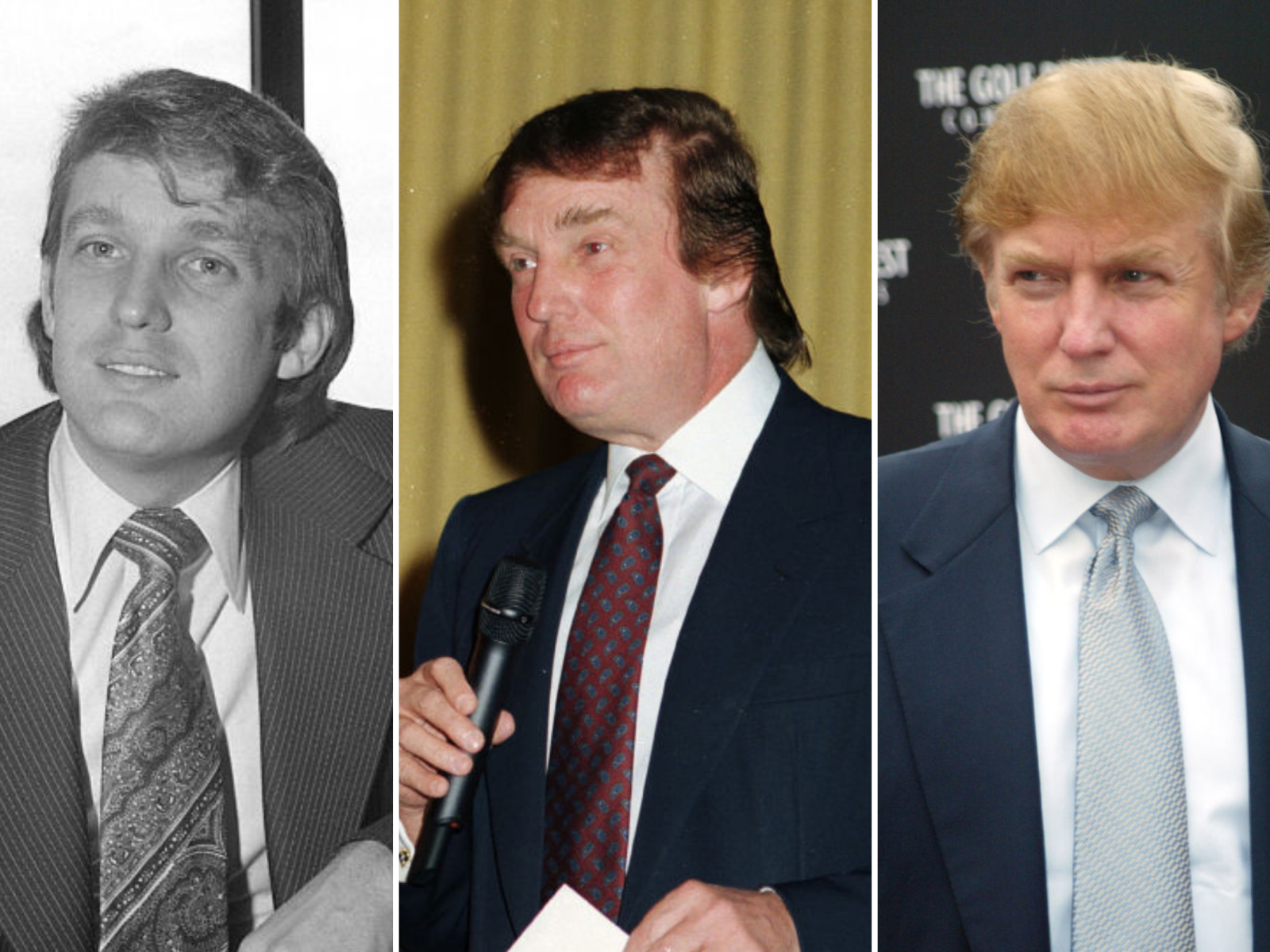 Why Is Donald Trump s Hair So Iconic Dr Resul Yaman Hair Clinic Why Is Donald Trump s Hair So Iconic Dr Resul Yaman Hair Clinic