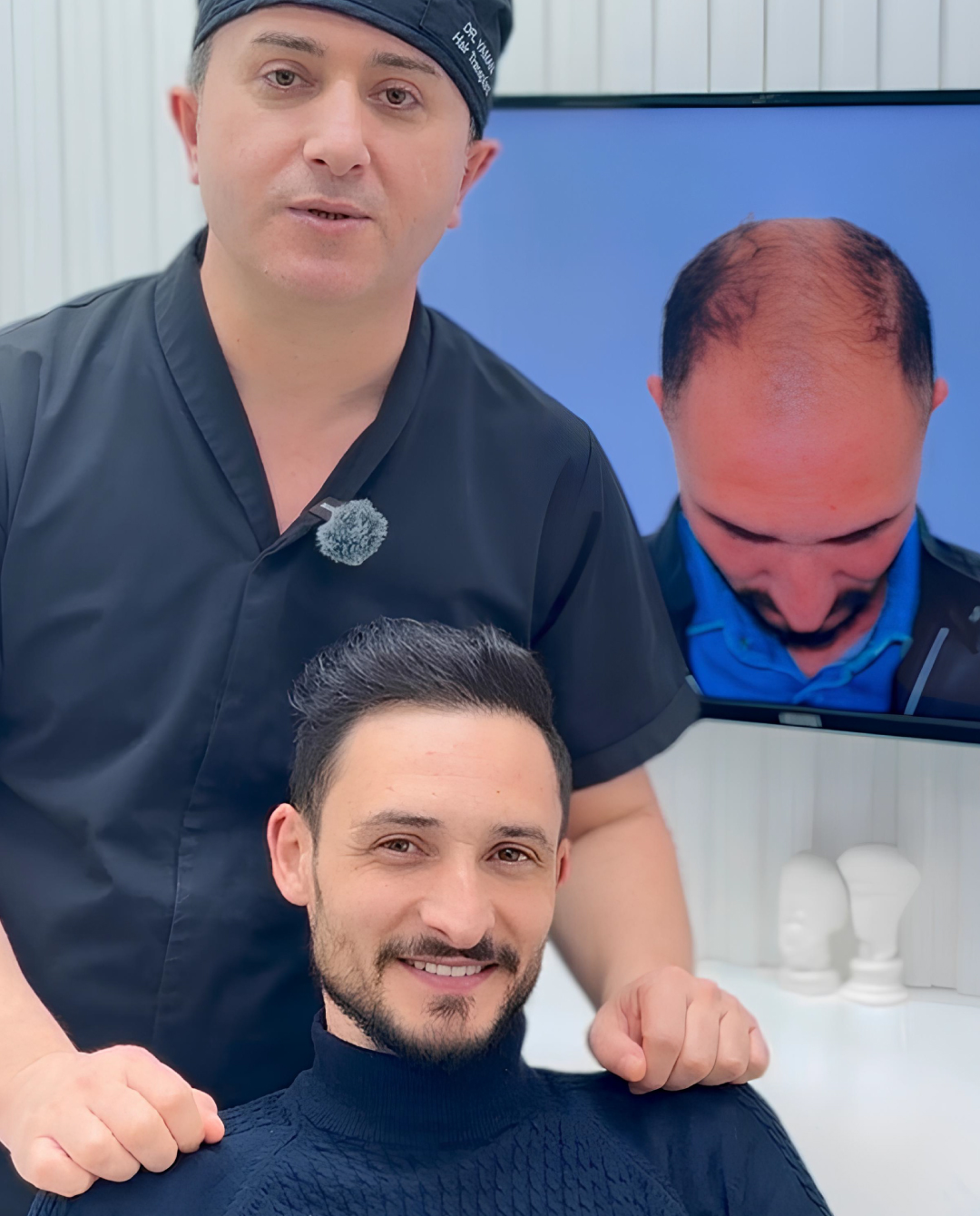 Hair Transplant Timeline