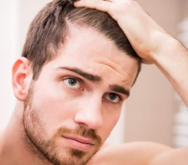 Cirurgia de redução da testa ou transplante da linha capilar: o que é mais indicado para si?