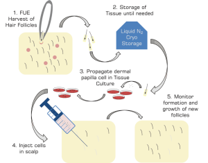 Hair Cloning: Could It Be the Baldness Cure?