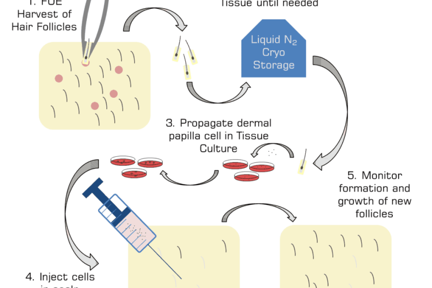 Clonazione dei capelli: potrebbe essere la cura per la calvizie?