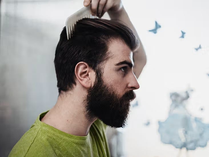 Gli steroidi causano la caduta dei capelli?