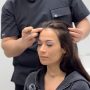 Female Hair Transplant: Techniques, Candidacy, Results and Long-Term Outcomes