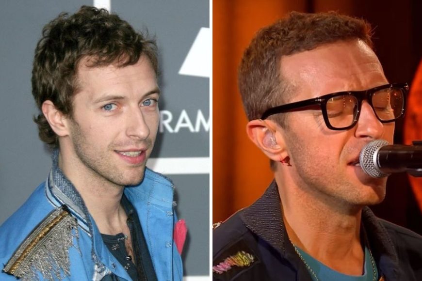 Chris Martin Hair Transplant: The Hair Journey of Coldplay’s Lead Singer