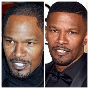 Jamie Foxx Hairline Surgery Timeline: 20 Years of Hair Transformation