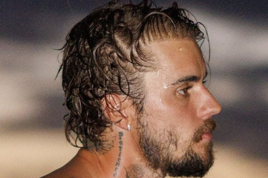 Justin Bieber Hair: Did the Famous Singer Get Hair Transplant?