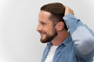 Hair Systems for Men