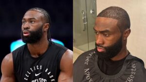 Jaylen Brown Hair: Should Jaylen Brown Get a Hair Transplant?