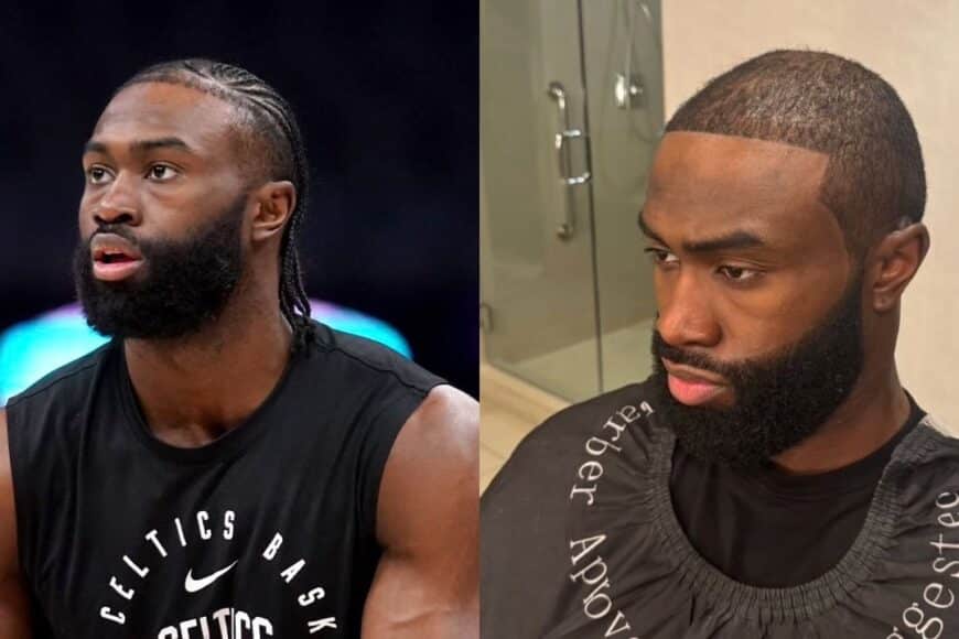 Jaylen Brown Hair: Should Jaylen Brown Get a Hair Transplant?