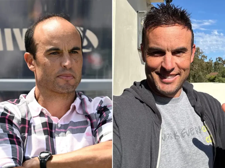 Landon Donovan Hair Transplant