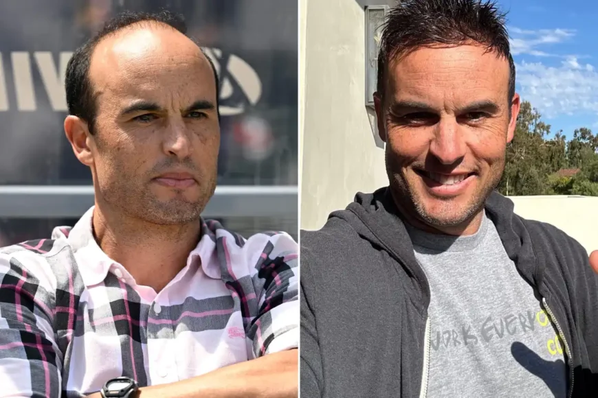 Landon Donovan Hair Transplant