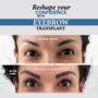 Do Eyebrows Grow Long after an Eyebrow Transplant?