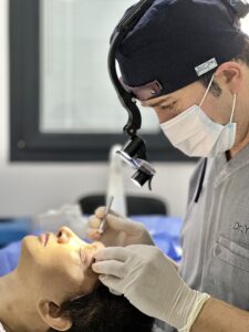 Thicker Brows with Eyebrow Transplant in Turkey