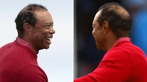 A Closer Look at Tiger Woods Hair Transplant Journey