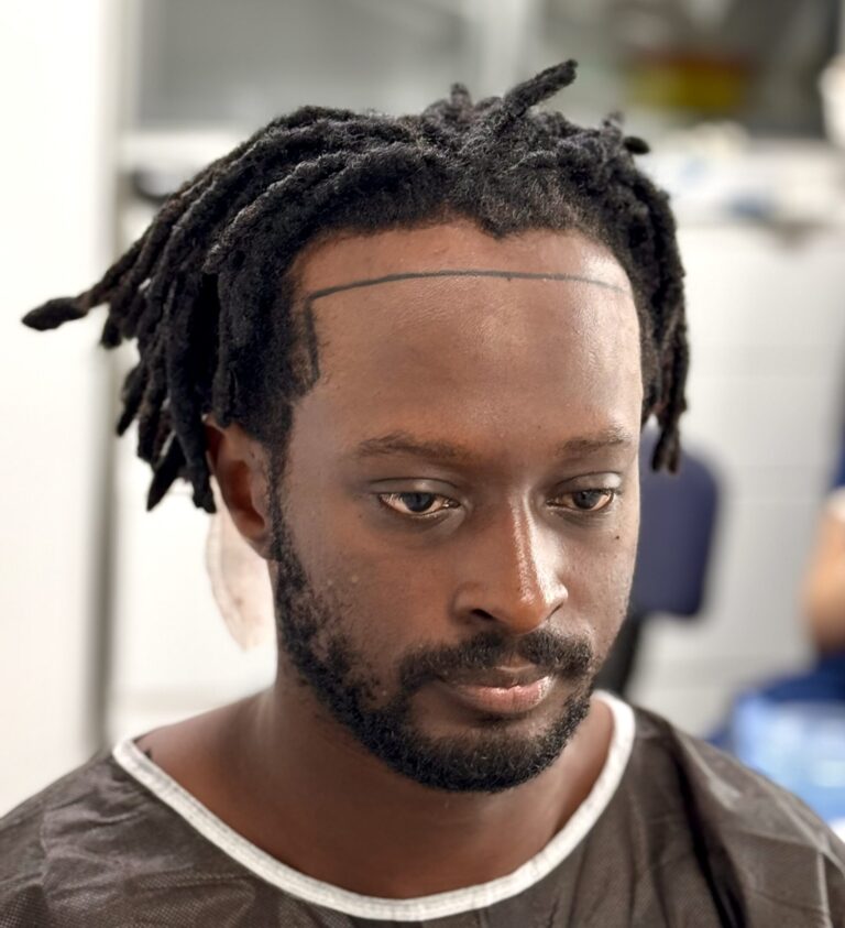 Afro hairline design