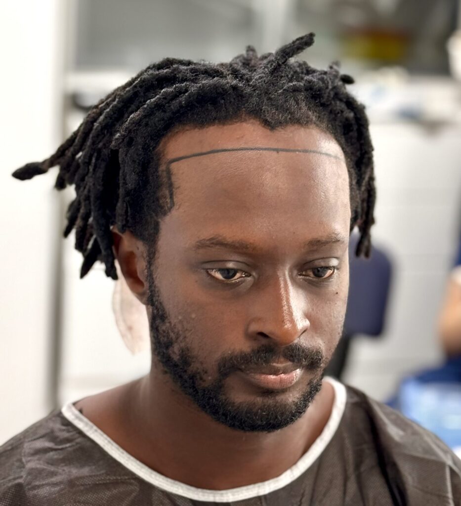 Afro hairline design