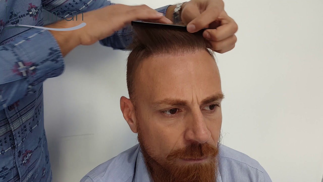 youtube placeholder image