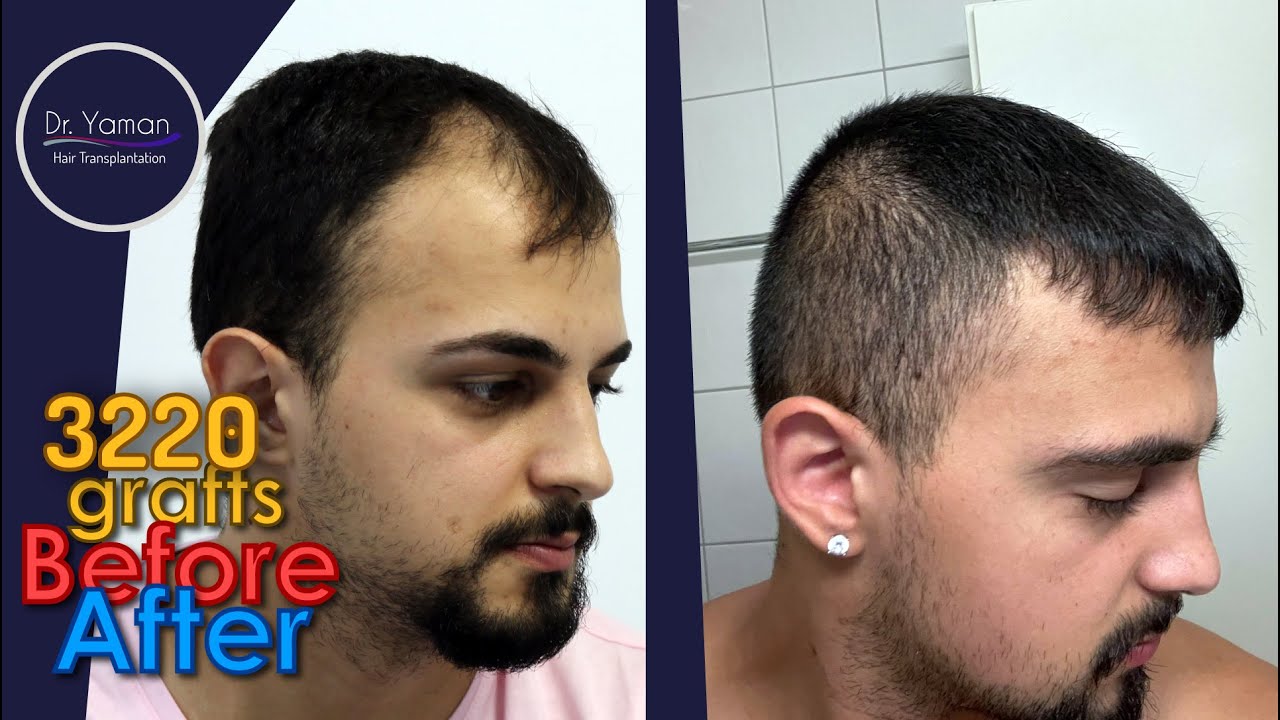 youtube placeholder image