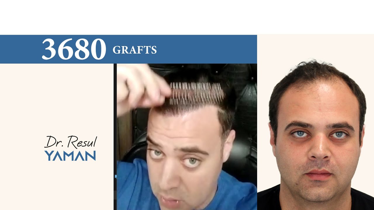 youtube placeholder image