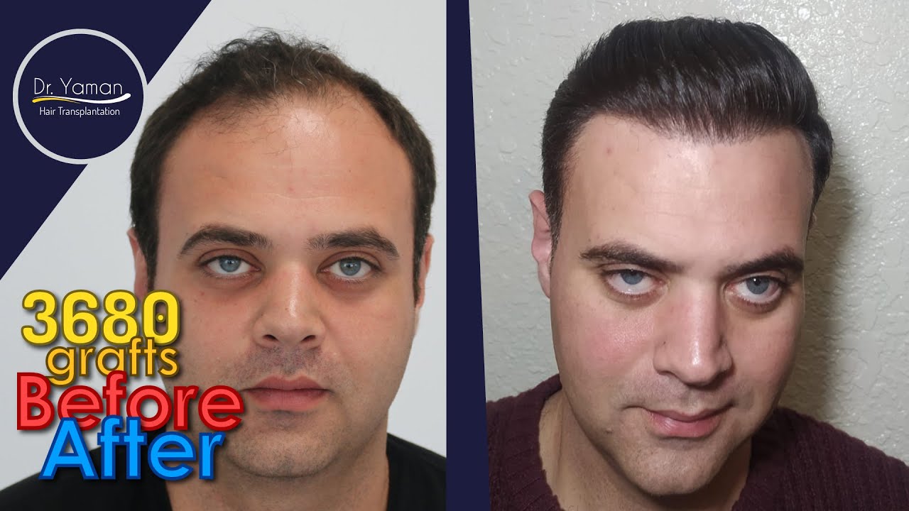 youtube placeholder image